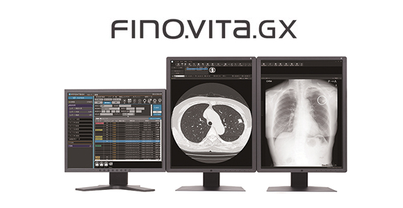 医用画像管理システム　FINO.VITA.GX