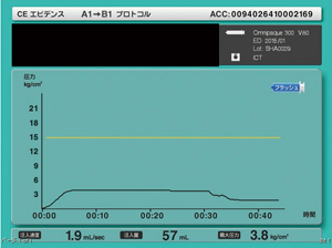 体重あたり1mLの造影剤を30秒注入