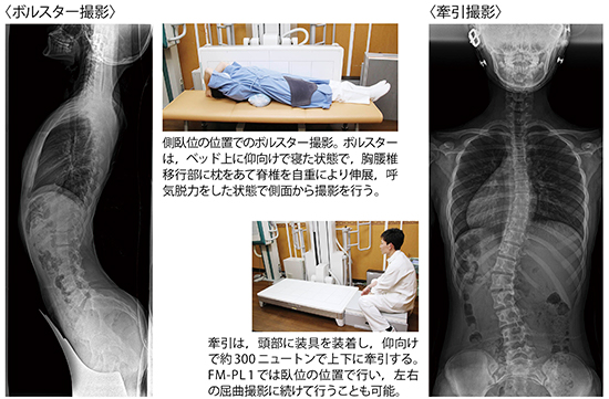 CALNEO GLによる臨床画像