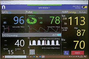 DENALI6168μとBluetoothで通信したPC側でも本体と同じようにデータを確認可能（測定項目：SpO2/Pulse/NIBP/CO2）
