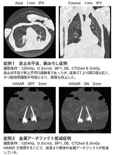 Supria Opticaによる臨床画像