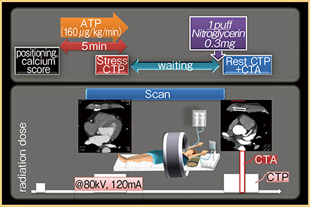 図1　Aquilion ONEによる心筋虚血評価のためのCTPプロトコール