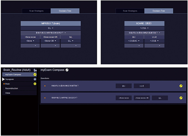 図4　頭部CT検査におけるdecision treeと検査時の画面