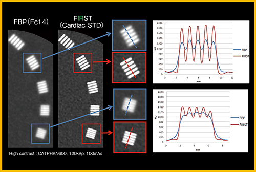 図3　バーパターンファントムでのFIRSTとFBP法の比較