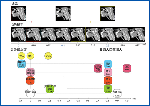 図3　PhyZiodynamicsによる三次元動態画像の補完