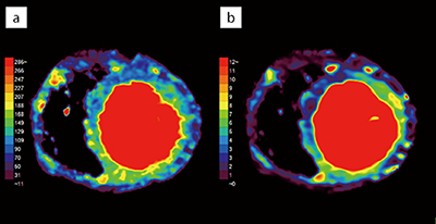 図2　心筋ダイナミック血流解析による結果表示