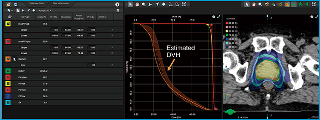 図1　RapidPlanを用いて計算した予測DVHとそれを用いた最適化の一例