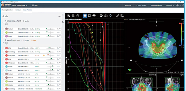 図2　新しいインタラクティブな線量オプティマイザIntelligent Optimization Engine