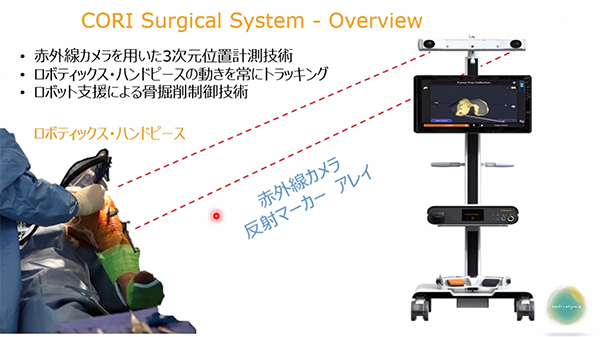 CORIサージカルシステムの概要