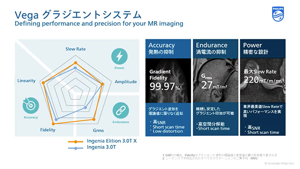 Vegaグラジエントシステムにより撮像時間短縮や高空間分解能化，高SNRを実現