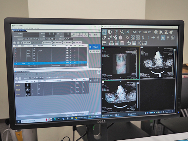 【インフォコム】放射線情報システム「iRadシリーズ」の検像システム「iRad-QA」